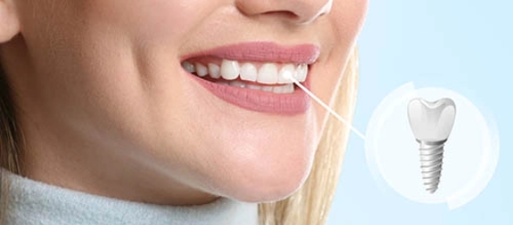 Seymour Dental Associates PLLC woman smiling with implants